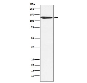 Western blot testing of human MCF7 cell lysate with SMARCA5 antibody. Predicted molecular weight ~122 kDa.