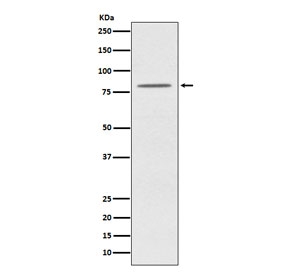 Western blot testing of human HeLa cell lysate with OPA1 antibody. Predicted molecular weight: 111-120 kDa with multiple smaller isoforms from 81-95 kDa.