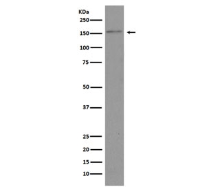 Western blot testing of human HeLa cell lysate with Brd4 antibody. Predicted molecular weight ~156 kDa (long form, can be observed at 200+ kDa) and ~81 kDa (short form).