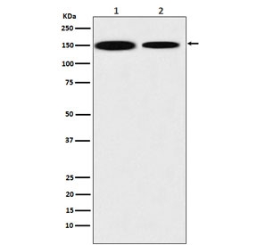 Western blot testing of 1) human HEK293 and 2) mouse NIH3T3 lysate with KDM4A antibody. Predicted molecular weight ~121 kDa.