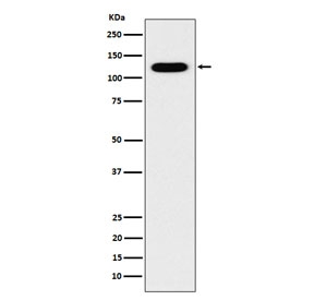 Western blot testing of human fetal kidney lysate with Cadherin 16 antibody. Expected molecular weight: 90-130 kDa.