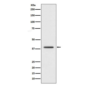 Western blot testing of human HepG2 cell lysate with H2AFY antibody. Predicted molecular weight ~40 kDa.