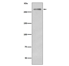 Western blot testing of mouse skeletal muscle with Dysferlin antibody. Predicted molecular weight ~230 kDa.