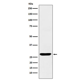 Western blot testing of human fetal brain lysate with SCGN antibody. Predicted molecular weight ~32 kDa.