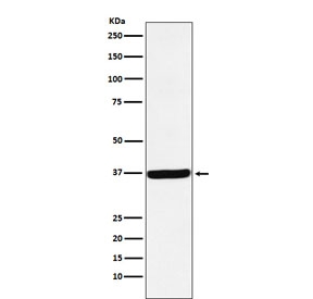 Western blot testing with DDAH1 antibody. Expected molecular weight: 31-38 kDa.