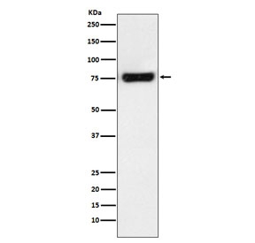 Western blot testing of human HeLa cell lysate with MTA2 antibody. Predicted molecular weight ~75 kDa.