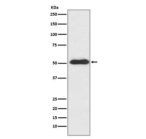 Western blot testing of human SH-SY5Y cell lysate with SLIT2 antibody. Expected molecular weight: ~180-210 kDa (full length), ~140 kDa (N-terminal fragment), 55-60 kDa (C-terminal fragment).