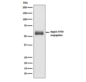 Western blot testing of human HepG2 lysate with ATG12 antibody. Expected molecular weight: ~15 kDa (ATG12) and 50-60 kDa (ATG12-ATG5 complex).