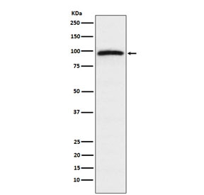 Western blot testing of human HeLa cell lysate with Epac1 antibody. Predicted molecular weight ~104 kDa.