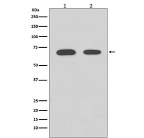 Western blot testing of human 1) HeLa and 2) 239T cell lysate with CHEK2 antibody. Predicted molecular weight ~61 kDa.