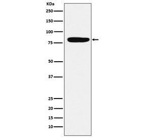 Western blot testing of human spleen lysate with Factor XIIIa antibody. Predicted molecular weight ~83 kDa.