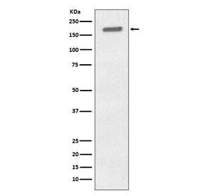 Western blot testing of lysate from human A431 cells treated with EGF with Phospho-EGFR antibody. Expected molecular weight: 134-170 kDa depending on glycosylation level.
