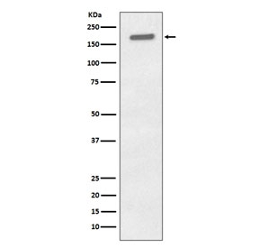 Western blot testing of lysate from human A431 cells treated with EGF with phospho-EGFR antibody. Expected molecular weight: 134-170 kDa depending on glycosylation level.