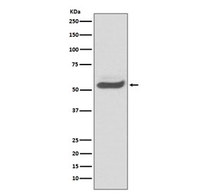 Western blot testing of human fetal kidney lysate with Alpha 1 Antitrypsin antibody. Expected molecular weight: 47-52 kDa depending on the level of glycosylation.