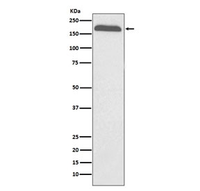 Western blot testing of human plasma lysate with Alpha-2-macroglobulin antibody. Expected molecular weight: 163-200 kDa depending on the level of glycosylation.