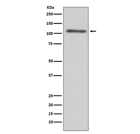 Western blot testing of human HepG2 cell lysate with C3 antibody. Expected molecular weight: ~185 kDa (alpha + beta chain), ~110 kDa (alpha chain), ~70 kDa (beta chain).