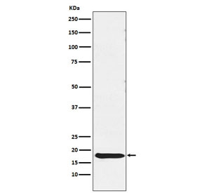 Western blot testing of human pituitary lysate with TSH beta antibody. Predicted molecular weight ~16 kDa.