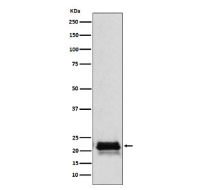 Western blot testing of human pituitary lysate with FSH beta antibody. Expected molecular weight: 17-23 kDa depending on level of glycosylation.