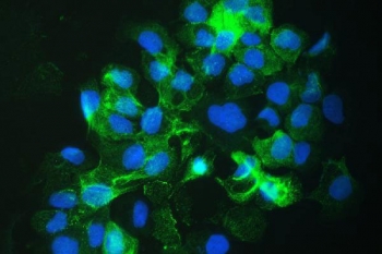 Immunofluorescent staining of FFPE human A431 cells with SLC34A2 antibody (green) and DAPI nuclear stain (blue). HIER: steam section in pH6 citrate buffer for 20 min.