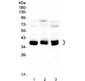Western blot testing of human 1) HEK293, 2) PC-3 and 3) HeLa lysate with CXCR4 antibody at 0.5ug/ml. Predicted molecular weight ~40 kDa but may be observed at higher molecular weights due to glycosylation.