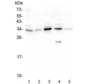 Western blot testing of human 1) PC-3, 2) Caco-2, 3) HEK293, 4) K562 and 5) U-2 OS lysate with PPA1 antibody at 0.5ug/ml. Predicted molecular weight: ~33 kDa.