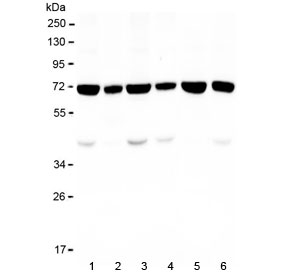 Western blot testing of human 1) HeLa, 2) placenta, 3) K562, 4) U-2 OS, 5) ThP1 and 6) A549 lysate with KBTBD2 antibody at 0.5ug/ml. Predicted molecular weight ~71 kDa.