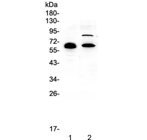 Western blot testing of human 1) placenta and 2) HL-60 lysate with CCDC36 antibody at 0.5ug/ml. Predicted molecular weight ~66 kDa.