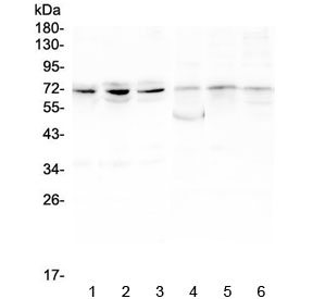 Western blot testing of 1) human PC-3, 2) human A549, 3) human HepG2, 4) rat ovary, 5) rat lung and 6) rat testis lysate with ARNTL2 antibody at 0.5ug/ml. Predicted molecular weight ~71 kDa.