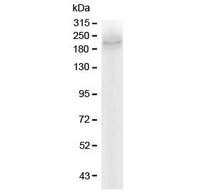 Western blot testing of human Caco-2 lysate with MRP2 antibody at 0.5ug/ml. Predicted molecular weight: 174-250 kDa depending on degree of glycosylation.