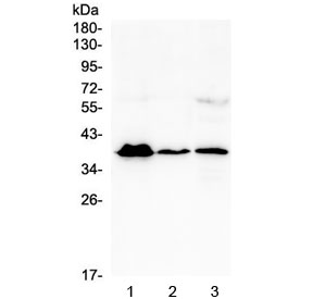Western blot testing of human 1) T-47D, 2) U937 and 3) A431 cell lysate with MR1 antibody at 0.5ug/ml. Predicted molecular weight ~39 kDa.