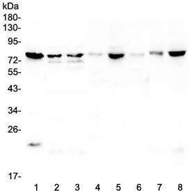 Western blot testing of 1) human PC-3, 2) human Caco-2, 3) human HepG2, 4) rat lung, 5) rat testis, 6) rat spleen, 7) mouse lung and 8) mouse testis lysate with POMT2 antibody at 0.5ug/ml. Predicted molecular weight ~84 kDa.