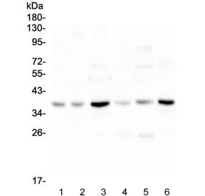 Western blot testing of 1) rat brain, 2) rat heart, 3) rat liver, 4) mouse brain, 5) mouse heart and 6) mouse liver lysate with SIRT4 antibody at 0.5ug/ml. Predicted molecular weight ~35 kDa.