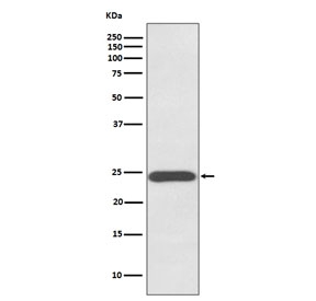 Western blot testing of human placenta lysate with Growth Hormone antibody. Predicted molecular weight: 22-25 kDa.