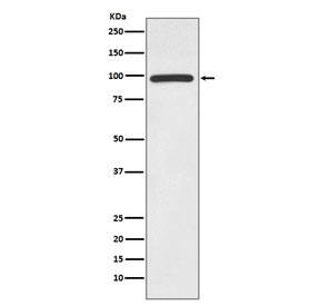 Western blot testing of human Jurkat cell lysate with HMGCR antibody. Predicted molecular weight ~97 kDa.