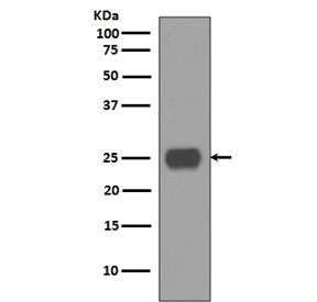 Western blot testing of human fetal brain lysate with CD90 antibody. Expected molecular weight 18~35 kDa depending on glycosylation level.