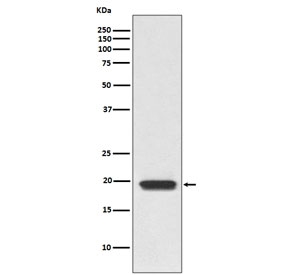 Western blot testing of human Jurkat cell lysate with CD3D antibody. Predicted molecular weight ~19 kDa.
