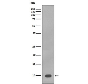 Western blot testing of human A375 cell lysate with S100 beta antibody. Predicted molecular weight ~11 kDa.