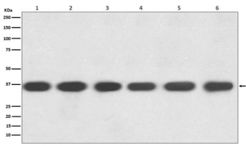 Western blot testing of 1) human HeLa, 2) human Jurkat, 3) mouse kidney, 4) mouse spleen, 5) mouse RAW264 and 6) rat brain lysate with GAPDH antibody. Predicted molecular weight ~36 kDa.