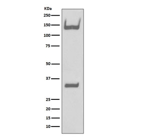 Western blot testing of human fetal brain lysate with TrkA/B/C antibody. Expected molecular weight: 85~140 kDa depending on glycosylation level.