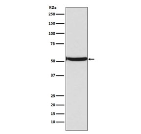 Western blot testing of lysate from human Jurkat cells treated with etoposide and TSA, with acetyl-p53 antibody (Lys382). Predicted molecular weight ~53 kDa.