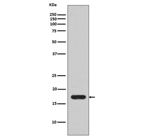 Western blot testing of recombinant human IL1 beta partial protein with IL1B antibody.