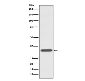 Western blot testing of human Ramos cell lysate with CD74 antibody. Expected molecular weight: 33-43 kDa.
