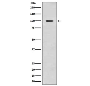 Western blot testing of mouse brain lysate with APP antibody. Predicted molecular weight 79~120 kDa depending on glycosylation level.