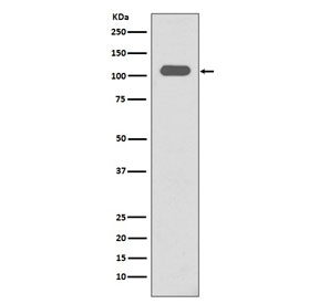 Western blot testing of human spleen lysate with ITGB3 antibody. Expected molecular weight: 87-110 kDa depending on glycosylation level.