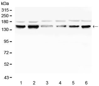 Western blot testing of human 1) K562, 2) HL60, 3) ThP-1, 4) Raji, 5) HeLa and 6) HepG2 cell lysate with RAB3GAP2 antibody. Predicted molecular weight ~156 kDa.