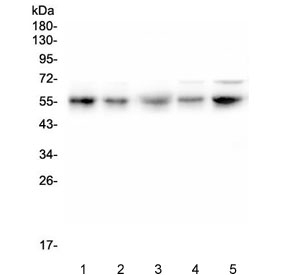 Western blot testing of human 1) U-2 OS, 2) PC-3, 3) U-87 MG, 4) A549 and 5) HeLa cell lysate with RBMS3 antibody. Expected molecular weight: 48-55 kDa.