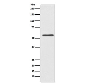 Western blot testing of human HeLa cell lysate with Cytochrome P450 2E1 antibody. Predicted molecular weight ~57 kDa.