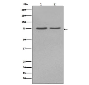 Western blot testing of human 1) HepG2 and 2) JAr cell lysate with ALPL antibody. Predicted molecular weight ~57 kDa, but can be observed at up to ~75 kDa due to glycosylation.