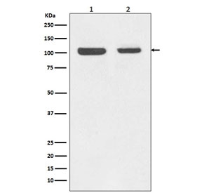 Western blot testing of human 1) Jurkat and 2) MCF7 cell lysate with Rb1 antibody. Predicted molecular weight ~110 kDa.