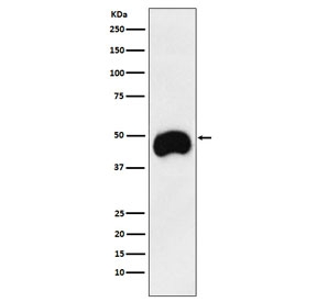 Western blot testing of human Jurkat cell lysate with CD2 antibody. Predicted molecular weight ~47 kDa.